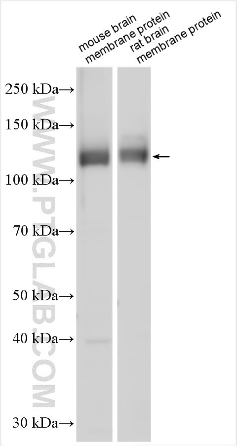 KCNMA1 Antibody in Western Blot (WB)