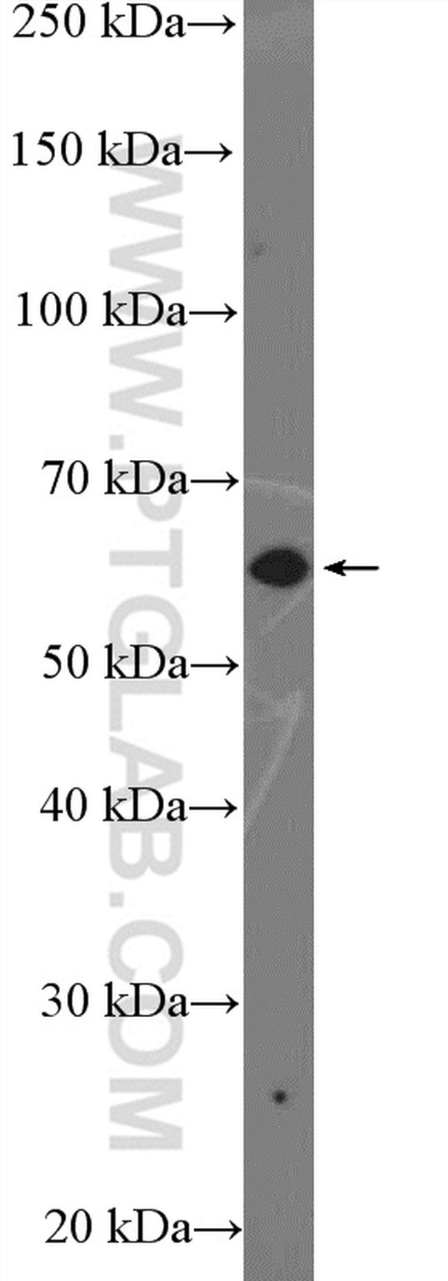ZNF154 Antibody in Western Blot (WB)