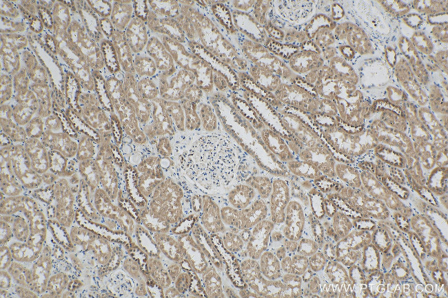 ZNF287 Antibody in Immunohistochemistry (Paraffin) (IHC (P))