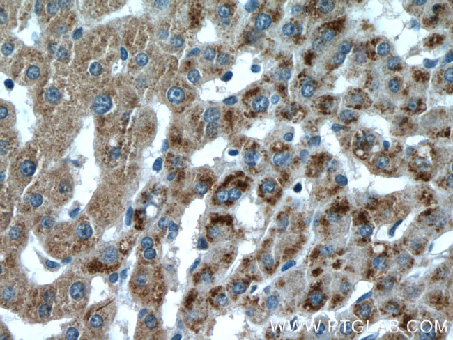 PXMP3 Antibody in Immunohistochemistry (Paraffin) (IHC (P))