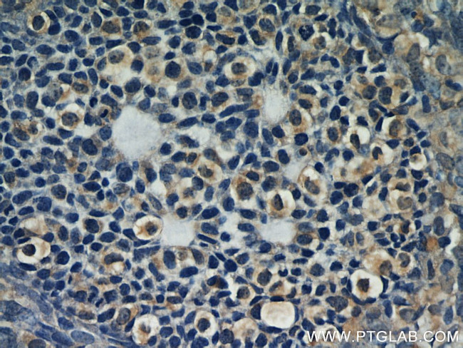 LPAR4 Antibody in Immunohistochemistry (Paraffin) (IHC (P))