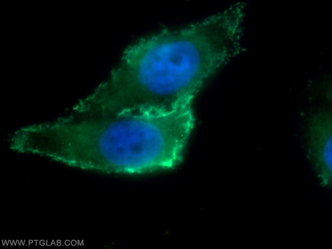 ARHGAP21 Antibody in Immunocytochemistry (ICC/IF)