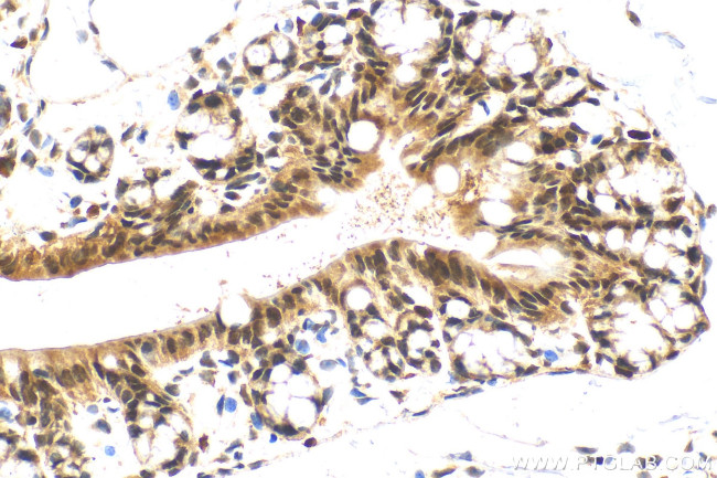 SS18 Antibody in Immunohistochemistry (Paraffin) (IHC (P))