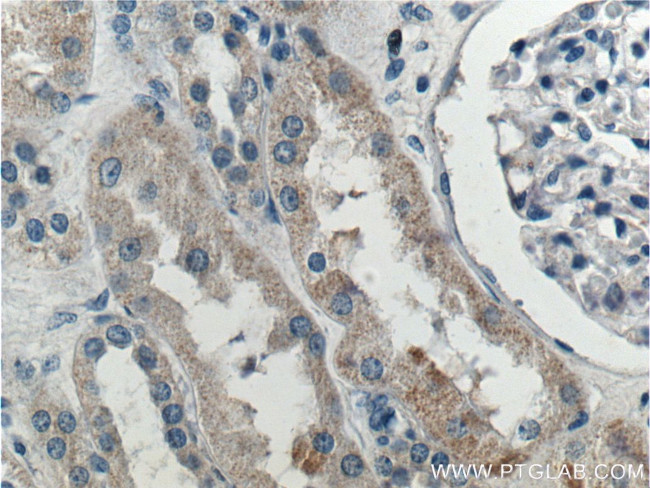 SNX21 Antibody in Immunohistochemistry (Paraffin) (IHC (P))