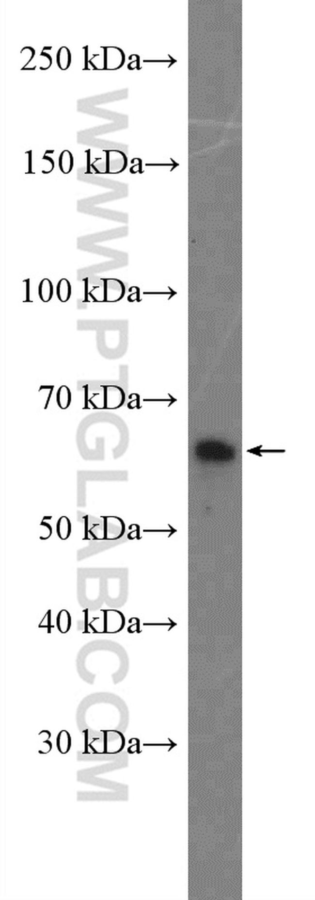 SH2B3 Antibody in Western Blot (WB)