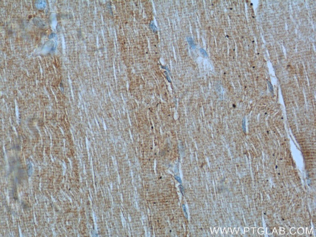 Desmin Antibody in Immunohistochemistry (Paraffin) (IHC (P))