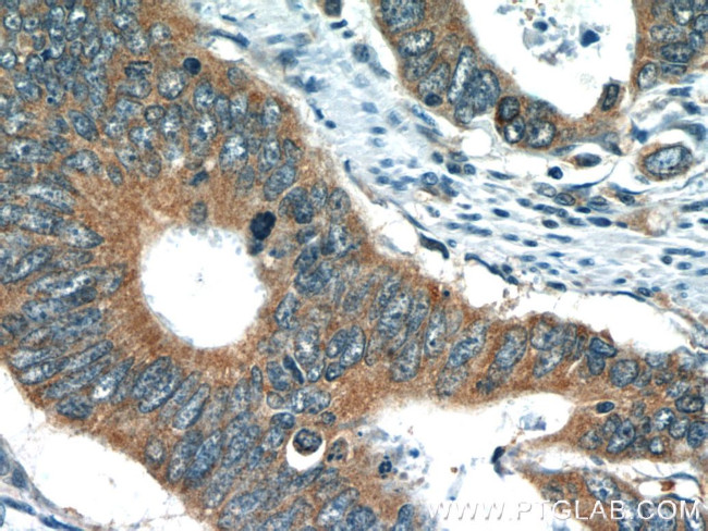 TMF1 Antibody in Immunohistochemistry (Paraffin) (IHC (P))