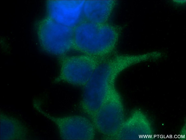 FERMT1 Antibody in Immunocytochemistry (ICC/IF)
