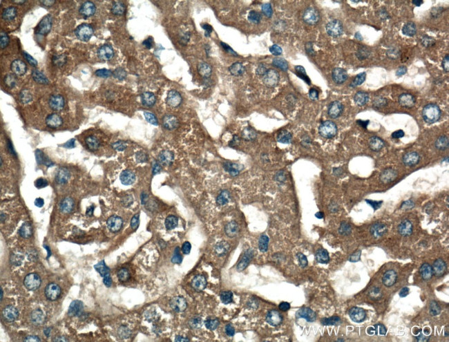 C4 alpha chain/C4b/C4d Antibody in Immunohistochemistry (Paraffin) (IHC (P))