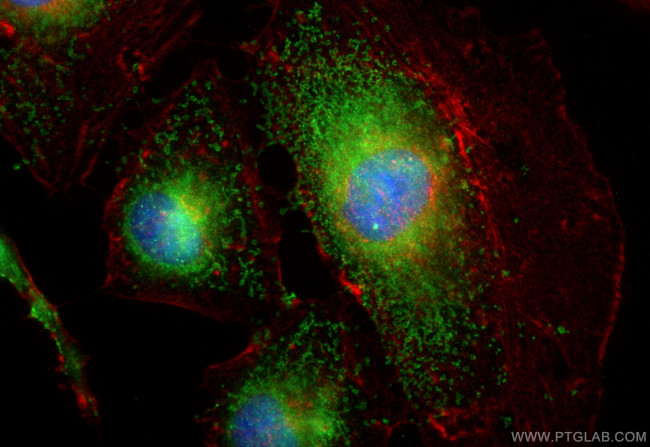 CA5A Antibody in Immunocytochemistry (ICC/IF)