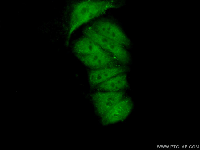 FAM98B Antibody in Immunocytochemistry (ICC/IF)