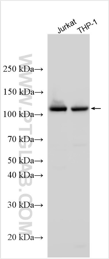 ESPL1 Antibody in Western Blot (WB)