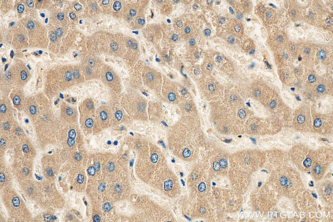 APOC3 Antibody in Immunohistochemistry (Paraffin) (IHC (P))
