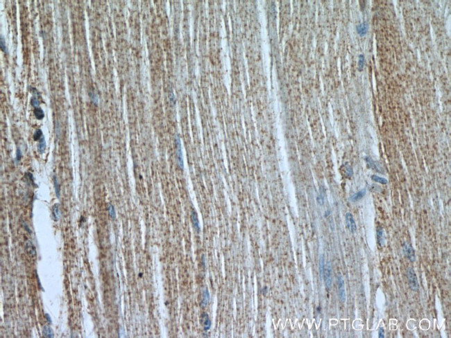 CACNA1S Antibody in Immunohistochemistry (Paraffin) (IHC (P))