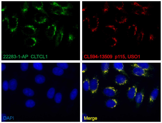 CLTCL1 Antibody in Immunocytochemistry (ICC/IF)