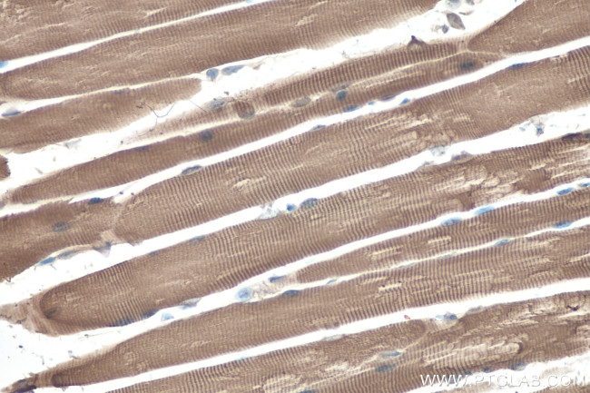 MYH13 Antibody in Immunohistochemistry (Paraffin) (IHC (P))