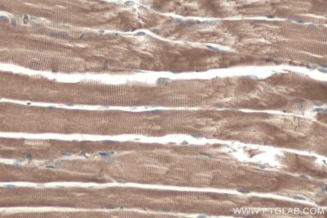 MYH15 Antibody in Immunohistochemistry (Paraffin) (IHC (P))