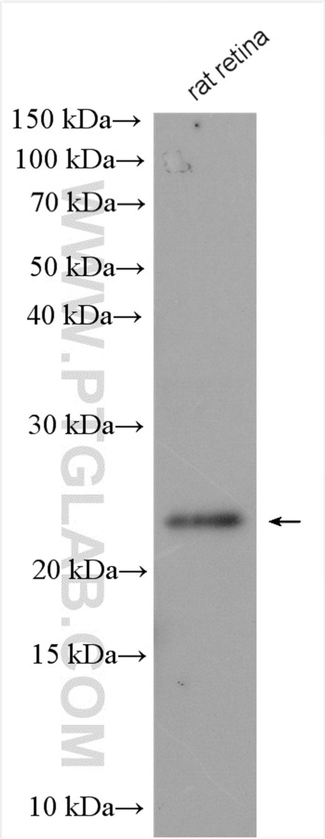 GCAP2 Antibody in Western Blot (WB)