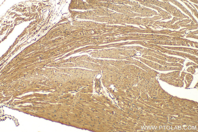 COL6A6 Antibody in Immunohistochemistry (Paraffin) (IHC (P))