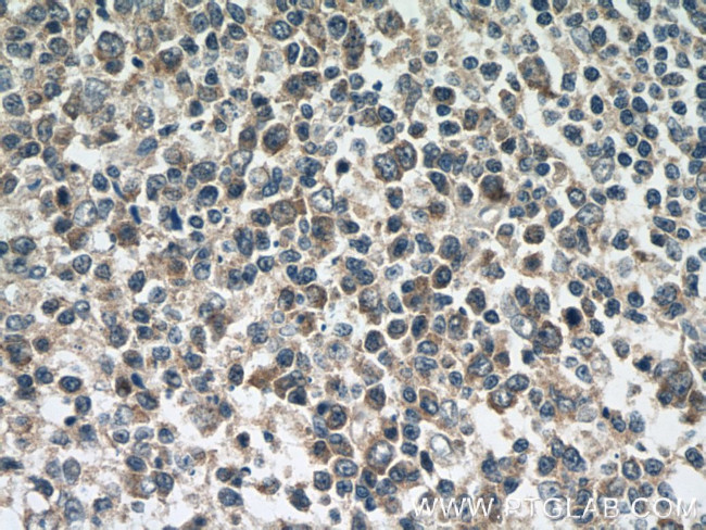 CCL18/MIP-4 Antibody in Immunohistochemistry (Paraffin) (IHC (P))