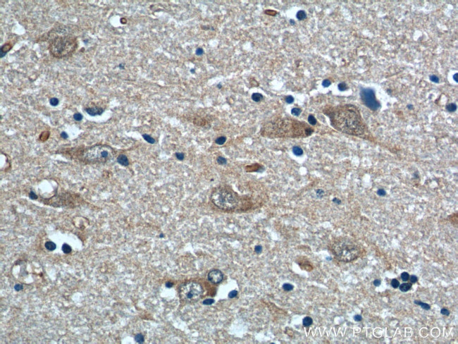 NPVF Antibody in Immunohistochemistry (Paraffin) (IHC (P))