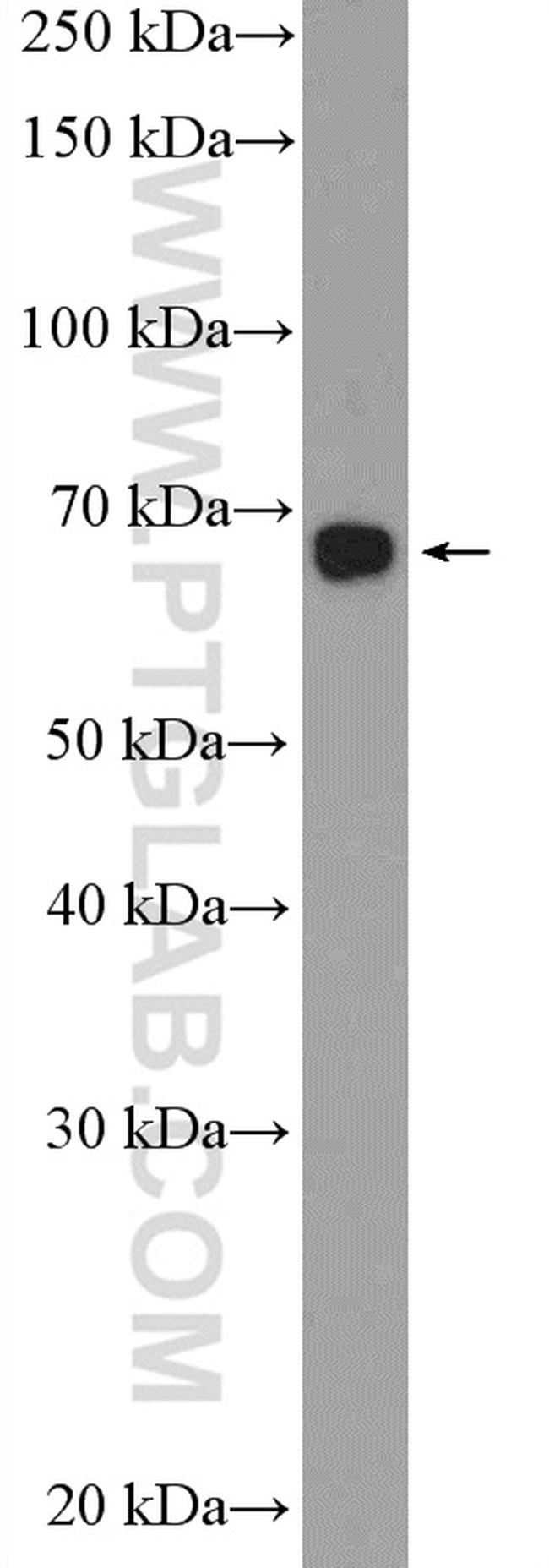PBX2 Antibody in Western Blot (WB)