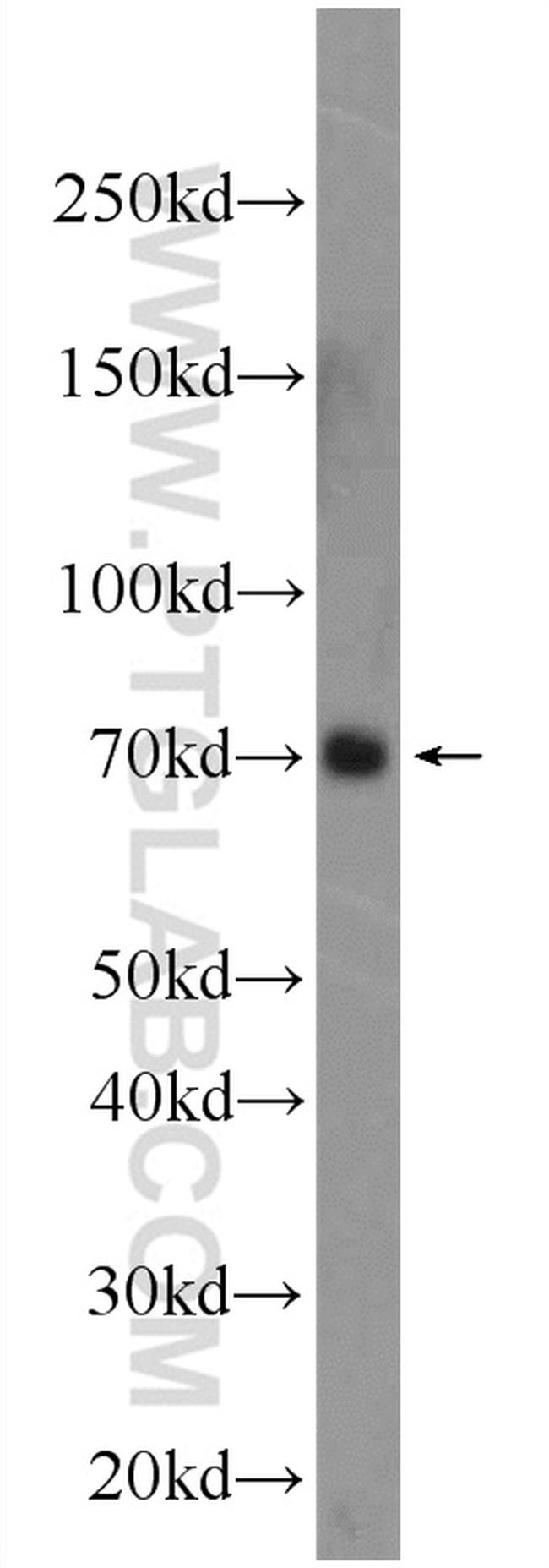 PBX4 Antibody in Western Blot (WB)