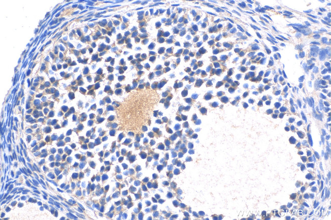 OVGP1 Antibody in Immunohistochemistry (Paraffin) (IHC (P))