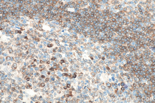 CD79A Antibody in Immunohistochemistry (Paraffin) (IHC (P))