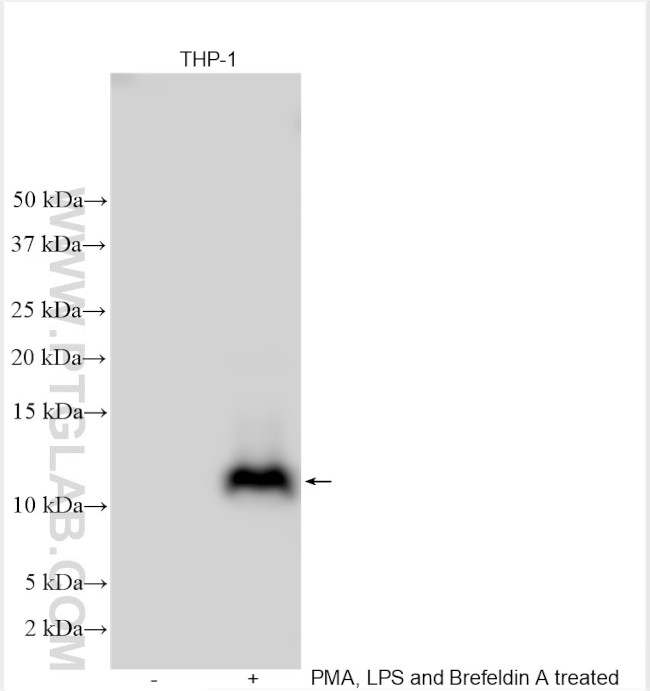 CCL4/MIP-1 beta Antibody in Western Blot (WB)