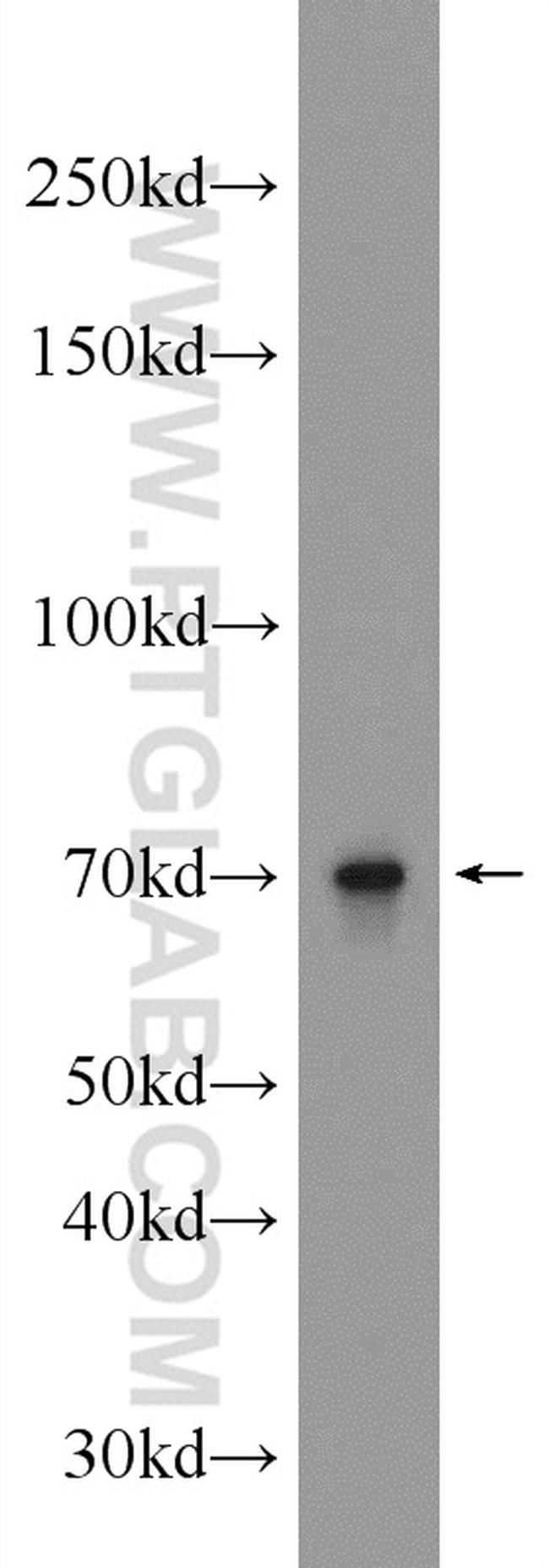 ALX3 Antibody in Western Blot (WB)