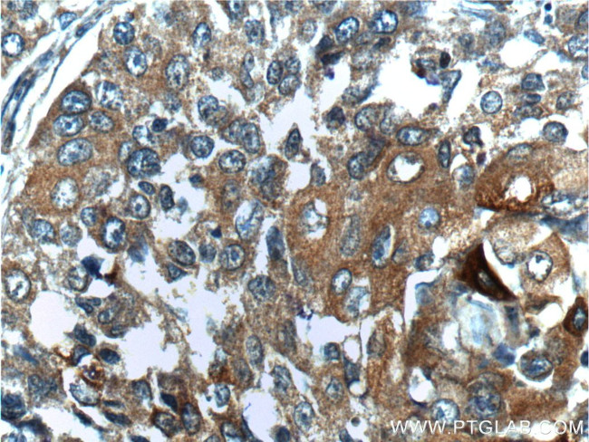 BRCA1 Antibody in Immunohistochemistry (Paraffin) (IHC (P))