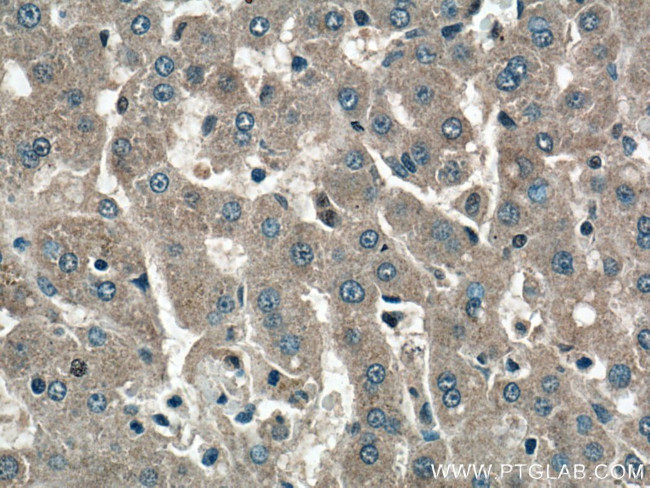 GYS2 Antibody in Immunohistochemistry (Paraffin) (IHC (P))