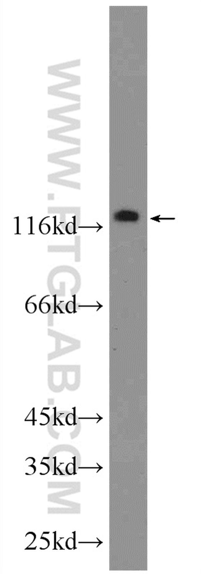 TTI1 Antibody in Western Blot (WB)
