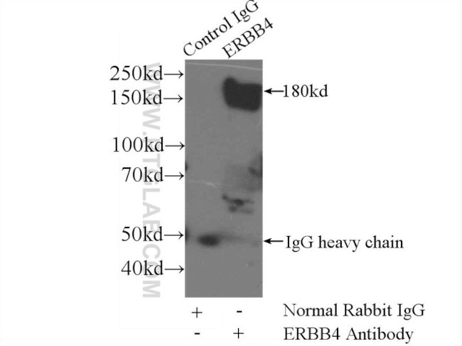 ERBB4 Antibody in Immunoprecipitation (IP)