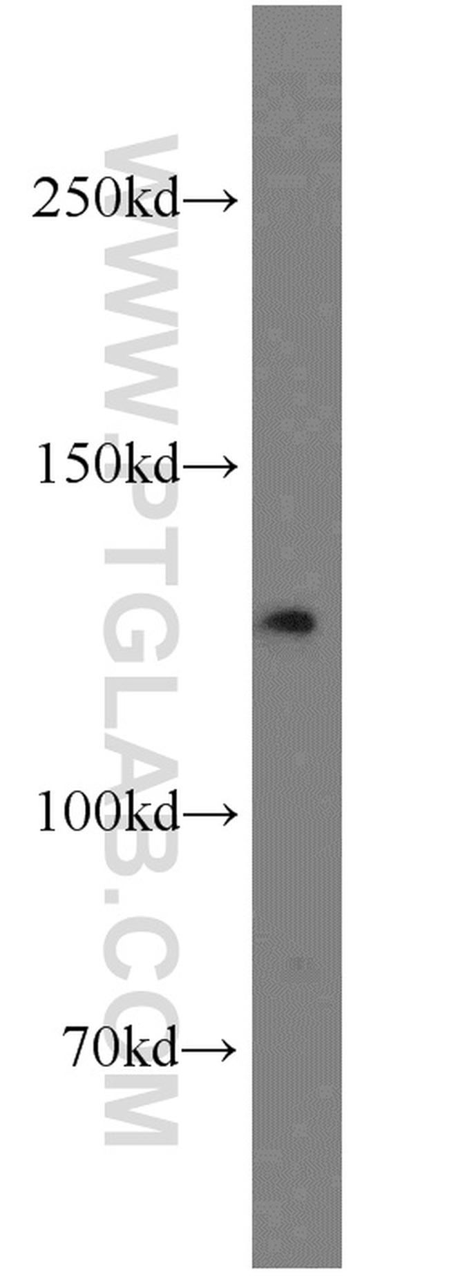 MSH3 Antibody in Western Blot (WB)