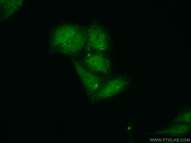 Syntenin-1 Antibody in Immunocytochemistry (ICC/IF)