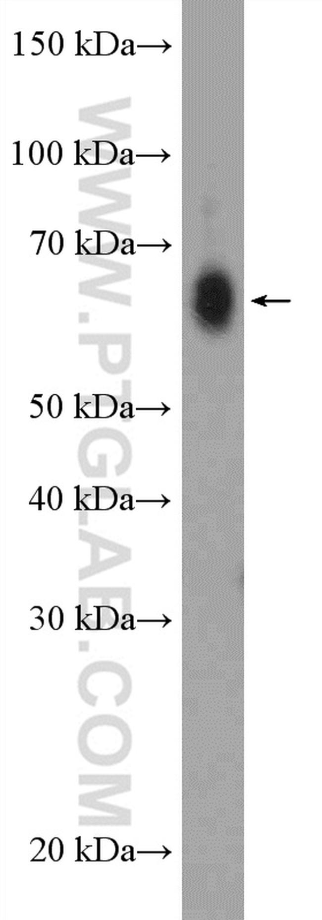 ZCCHC7 Antibody in Western Blot (WB)