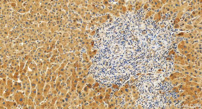 Adiponectin receptor 1 Antibody in Immunohistochemistry (Paraffin) (IHC (P))