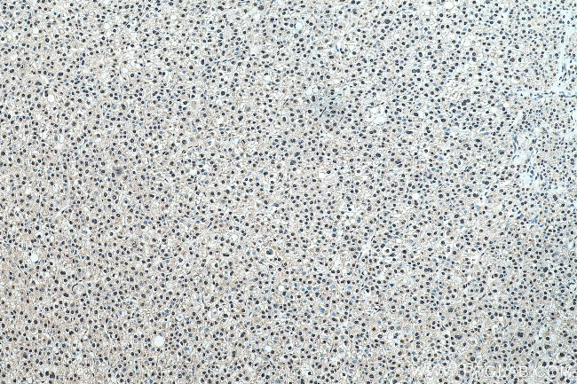 SNRPC Antibody in Immunohistochemistry (Paraffin) (IHC (P))