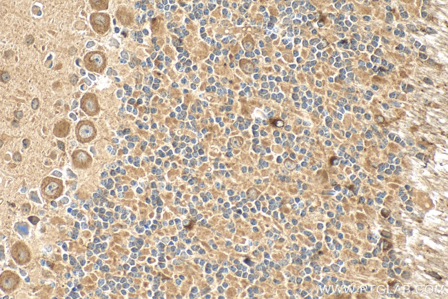 CDIPT Antibody in Immunohistochemistry (Paraffin) (IHC (P))