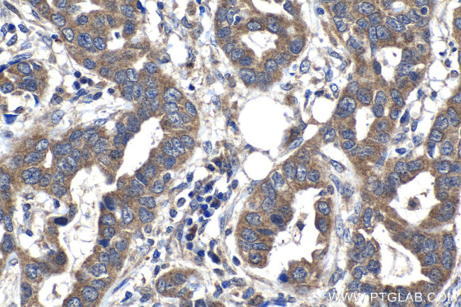 SPDYC Antibody in Immunohistochemistry (Paraffin) (IHC (P))