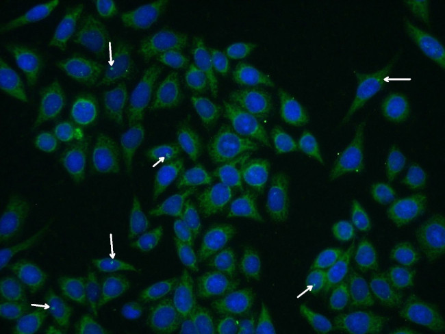 CEP290 Antibody in Immunocytochemistry (ICC/IF)