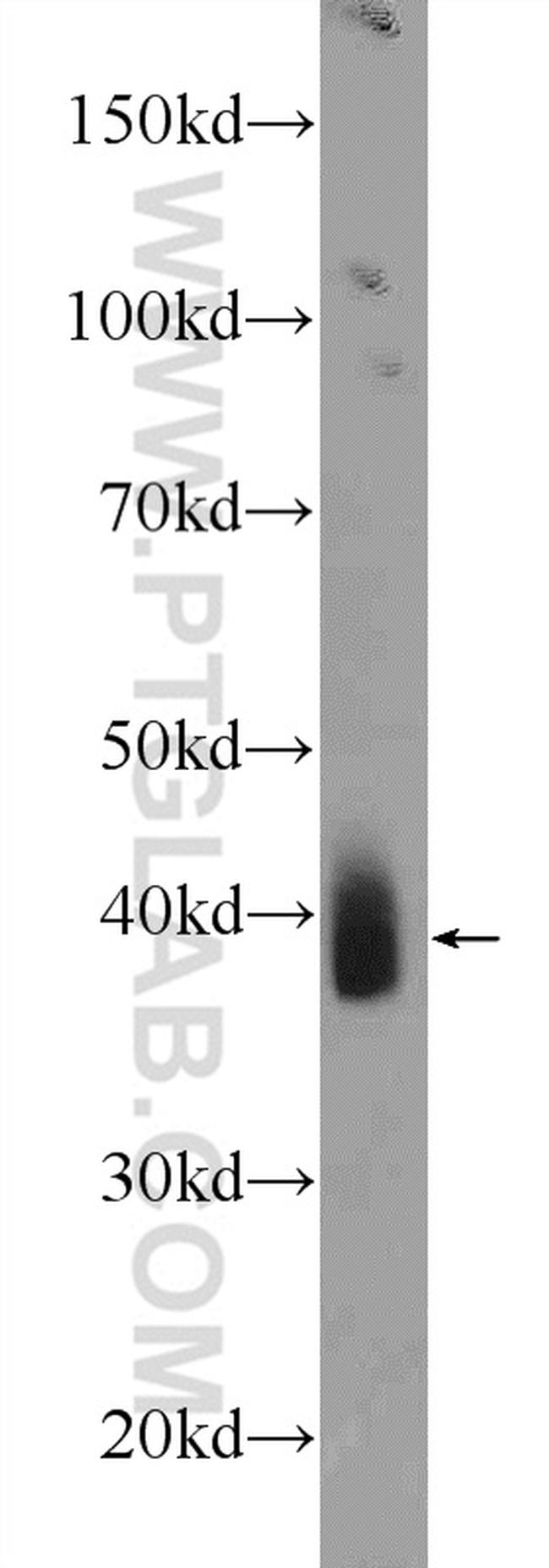 NKX3-2 Antibody in Western Blot (WB)