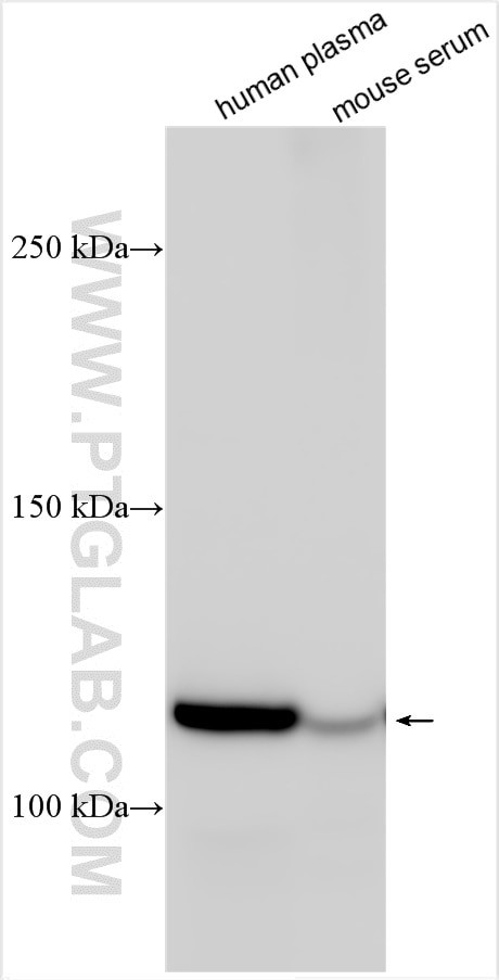 C5 Antibody in Western Blot (WB)
