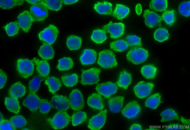 PPP1R3A Antibody in Immunocytochemistry (ICC/IF)