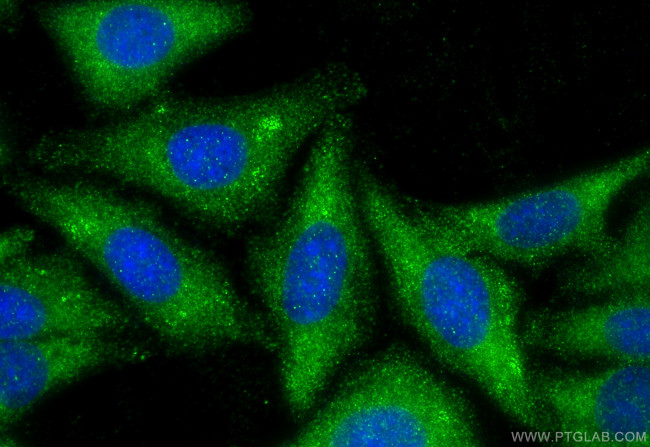 LLGL1 Antibody in Immunocytochemistry (ICC/IF)