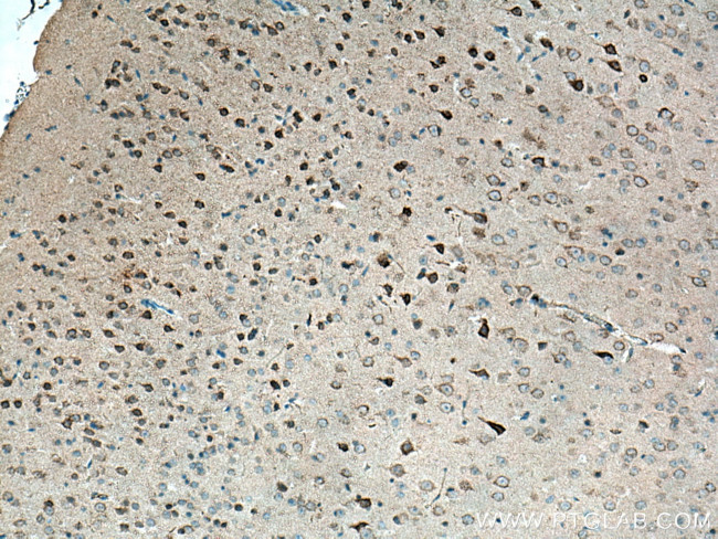 DAT Antibody in Immunohistochemistry (Paraffin) (IHC (P))