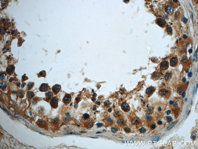 TMEM168 Antibody in Immunohistochemistry (Paraffin) (IHC (P))