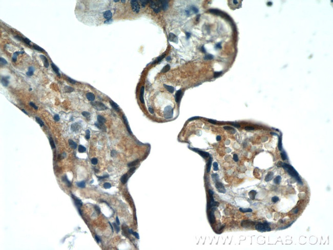FAM129B Antibody in Immunohistochemistry (Paraffin) (IHC (P))